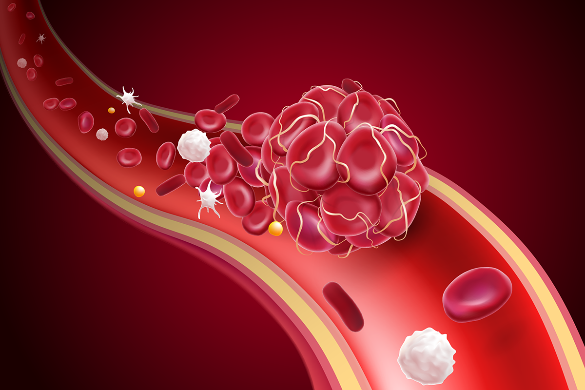 Imagen Destacada - Anticoagulantes orales directos (ACOD)